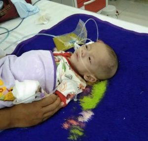 Zacky Rafaasaa (3 bulan) putra dari Alan Budi Kusuma dan Santi Dahlia Warga Kecamatan Betung Kabupaten Banyuasin yang menderita Intususepti atau Usus Terlipat. (foto : SMSI Banyuasin)