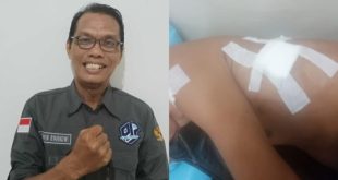 Darwin Syakorwi, M.kom Ketua DPD PJS Sumsel dan Hendri Syahputra Korban Penusukan.